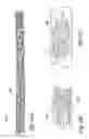 Fig. 41 - Method for permanent occlusion of fallopian tube