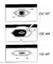 Fig. 44 - Method for permanent occlusion of fallopian tube