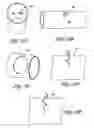 Fig. 47 - Method for permanent occlusion of fallopian tube