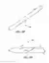 Fig. 50 - Method for permanent occlusion of fallopian tube