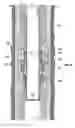 Fig. 10 - Coupler retained liner hanger mechanism and methods of setting a hanger inside a wellbore
