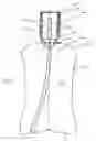 Fig. 02 - Dosing bottle and method