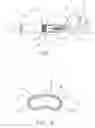 Fig. 02 - Eddy Current Probe And Method Of Manufacture Thereof