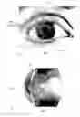 Fig. 02 - Method for acquiring the shape of the iris of an eye