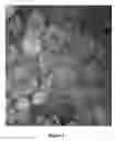 Fig. 02 - METHODS AND COMPOSITIONS FOR INHIBITING UNDESIRABLE CELLULAR PROLIFERATION BY TARGETED LIPOSOME DELIVERY OF ACTIVE AGENTS