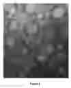 Fig. 03 - METHODS AND COMPOSITIONS FOR INHIBITING UNDESIRABLE CELLULAR PROLIFERATION BY TARGETED LIPOSOME DELIVERY OF ACTIVE AGENTS