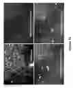 Fig. 13 - METHODS AND COMPOSITIONS FOR INHIBITING UNDESIRABLE CELLULAR PROLIFERATION BY TARGETED LIPOSOME DELIVERY OF ACTIVE AGENTS