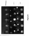 Fig. 20 - METHODS AND COMPOSITIONS FOR INHIBITING UNDESIRABLE CELLULAR PROLIFERATION BY TARGETED LIPOSOME DELIVERY OF ACTIVE AGENTS