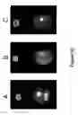 Fig. 23 - METHODS AND COMPOSITIONS FOR INHIBITING UNDESIRABLE CELLULAR PROLIFERATION BY TARGETED LIPOSOME DELIVERY OF ACTIVE AGENTS