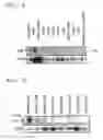 Fig. 02 - Breast cancer related protein, gene encoding the same, and method of diagnosing breast cancer using the protein and gene