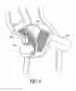 Fig. 09 - Rescue harness