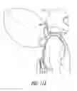 Fig. 22 - Rescue harness