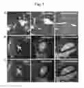 Fig. 02 - Use of 24-nor-UDCA