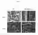 Fig. 02 - Compositions and methods for using acyltransferases for altering lipid production on the surface of plants
