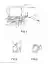 Fig. 02 - FINGER-MOUNTED OR ROBOT-MOUNTED TRANSDUCER DEVICE
