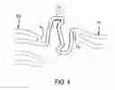 Fig. 05 - Endoprosthesis having flexible connectors