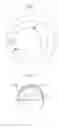 Fig. 02 - Medical implant component and method for fabricating same
