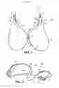 Fig. 02 - Device for use with an eye protector