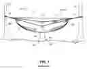 Fig. 02 - Hammock Having Insulation Retaining Panels