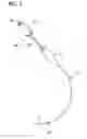 Fig. 02 - LUBRICIOUS INTUBATION DEVICE