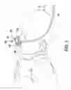 Fig. 02 - Continuous positive airway pressure device