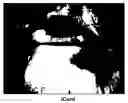 Fig. 02 - Intelligent Power Cord Device ( iCord)