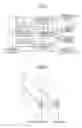 Fig. 02 - Noise reduction device for a video signal and noise reduction method for a video signal