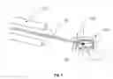 Fig. 02 - Device and method for positioning a target volume in radiation therapy apparatus
