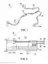 Fig. 02 - Earphone Antenna