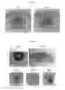 Fig. 02 - Multi-scale variable domain decomposition method and system for iris identification