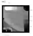 Fig. 03 - Method for operating an x-ray diagnostic apparatus for determining quality values