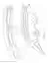 Fig. 08 - Turbine nozzle segment