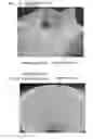 Fig. 09 - MOLD AND MANUFACTURING METHOD THEREOF, AND MOLDED ARTICLE USING THE MOLD