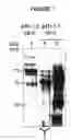 Fig. 02 - Polypeptides of and polynucleotides encoding same and vaccinal, therapeutical and diagnostic applications thereof