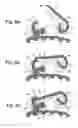 Fig. 09 - Self-ligating orthodontic bracket