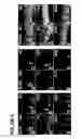 Fig. 04 - Use of regulatory sequences for specific, transient expression in neuronal determined cells
