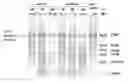 Fig. 01 - Single enzyme system for fast, ultra long PCR