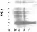 Fig. 09 - 84P2A9: a prostate and testis specific protein highly expressed in prostate cancer