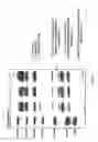 Fig. 04 - Formation of superfibronectin by BBK32 and uses therefor