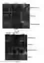 Fig. 05 - Formation of superfibronectin by BBK32 and uses therefor