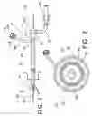 Fig. 02 - METHOD FOR REMOVING A MEDICAL DEVICE FROM A SPASMODIC CONSTRICTION IN A BODILY PASSAGEWAY
