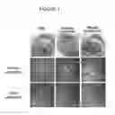 Fig. 02 - OPHTHALMIC MICELLAR COMPOSITIONS WITH ENHANCED STABILITY