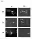Fig. 07 - Method for determining inhibitors of neurotrypsin