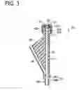 Fig. 04 - INSERTION ASSISTING TOOL FOR AN ENDOSCOPE