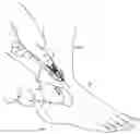 Fig. 01 - Articular injection system