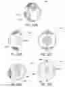 Fig. 83 - Articular injection system