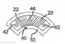 Fig. 01 - Pre-filter for an ostomy bag