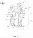 Fig. 02 - Body adhering absorbent article