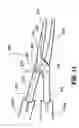 Fig. 17 - Vessel sealing instrument