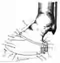 Fig. 01 - Hoof balancer and limb alignment tool